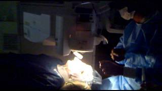 Lasikwavefrontlaser eye surgery cost in Turkey  OpDrMustafa Mete [upl. by Araik]