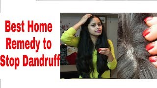 How to get rid from dandruff in Hindi Dandruff treatment home remediestips amp tricks of haircare [upl. by Nodnar]