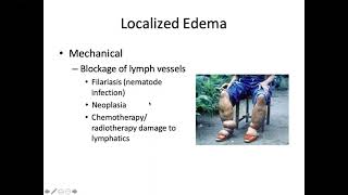 Hemodynamics Thromboembolic Diseases Shock [upl. by Vikky]