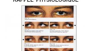 Troubles de la motilité oculaire Diplopie Strabisme [upl. by Merci870]