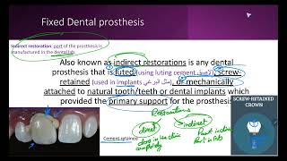 Introduction to Fixed Prosthodontics [upl. by Boys]