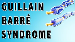 GuillainBarré Syndrome [upl. by Ylle]