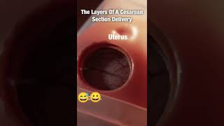 The leyers of A cesarean section Delivery demo C section for baby delivery 🥰🥰viralshort [upl. by Nyral147]