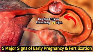 5 Major Signs of Fertilized EggSign of Early PregnancyImplantation Bleeding [upl. by Ojaras]