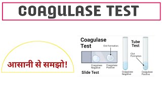 Introduction to Microbiology in Hindi  Microbiology with Sumi [upl. by Nauwtna]