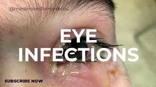 eye infections I MICROBIOLOGY I SECOND YEAR MBBSI USMLE I NEXT [upl. by Leunammi]