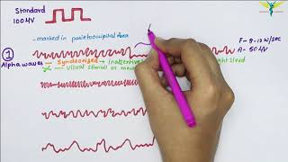 Electroencephalogram EEG  Waves  Physiology [upl. by Onailime946]