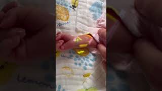 Suresult Vein Finder Master Safe Vein Viewer on Newborn Arms [upl. by Amiarom]