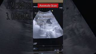 Anomaly Scan  Antenatal Ultrasound ❤️💯 medical anomaly ultrasound pregnancy shorts [upl. by Norabal]