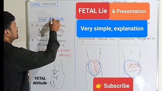 Fetal Attitude lie amp presentation  Antenatal examination  Lecture41  Midwifery amp Gynecological [upl. by Youngman963]