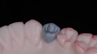 Encerado de primer premolar inferior en modelo MTJ [upl. by Wardle]