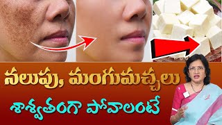 Natural Tip for Dark Spots on Face  Get Rid of Pigmentation  DrLalitha Reddy Beauty Tips [upl. by Peadar822]