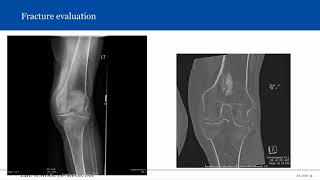 Introduction to Musculoskeletal Radiology [upl. by Antrim]