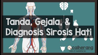 Tanda Gejala dan Diagnosis Sirosis Hati Deteksi Sirosis Hati dan Gagal Hati [upl. by Ruffi297]