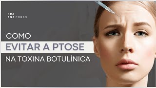 Como evitar a ptose na toxina botulínica [upl. by Wilbert]