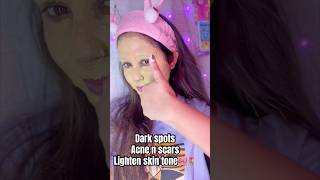 Dark spots Acne n scars Lighten skin tone🎀🌷ytshorts shorts skincare viralvideo trending [upl. by Rednasyl309]