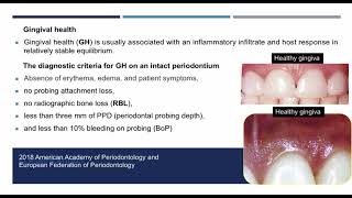 Gingival diseases in children part 1 [upl. by Munn568]