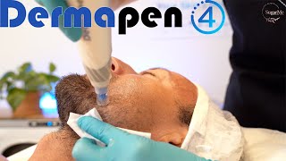 DermaPen Microneedling Anti aging Meso Glide treatment with a male first time Dermapen client [upl. by Uphemia]