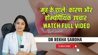 Mouth Ulcers Causes amp Homeopathic Remedies  Dr Saroha Homeopathy [upl. by Ahsad]