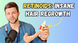 Minoxidil with Tretinoin The WEIRD Way Retinoids Restore Hair Growth [upl. by Lynelle]