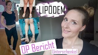 Lipödem  OP Bericht  Meine UnterschenkelOP  LipoClinic  Teil 1 [upl. by Taffy]