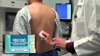 Preparing for Scoliosis Surgery  CHOC Childrens [upl. by Eyar]