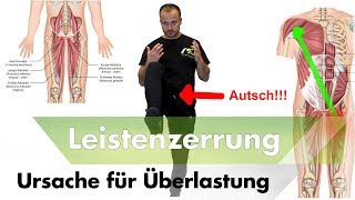 Leisten amp Adduktorenzerrungen  1 Der Hauptursachen [upl. by Portwin]