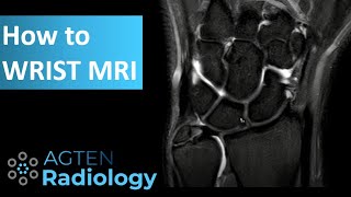 How to Assess Wrist MRI [upl. by Palm]