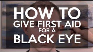 How to Treat a Black Eye  WebMD [upl. by Nawd828]