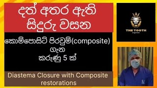 දත් අතර සිදුරු වසන දතේ පාට පිරවුම් l Composite restorations l Diastema closure lGaps between teeth [upl. by Aeht]