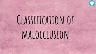 Angles Classification of Malocclusion  Easily Explained [upl. by Matthieu]