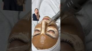 Watch Out BB Glow Facial Could Be Your Beauty Nightmare [upl. by Keram612]