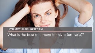 What is the best treatment for hives urticaria [upl. by Ankeny]