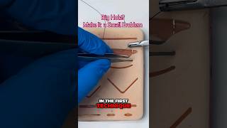 Close A Big Hole suturing operation surgery medsudent medicalstudent doctor workoutmotivation [upl. by Naenej]