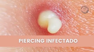 Piercing Infectado ¿Cómo saber si mi perforación esta infectada [upl. by Ilecara]