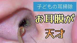 子どもの耳掃除 お耳膜のファーストインパクト👂 [upl. by Athalee428]