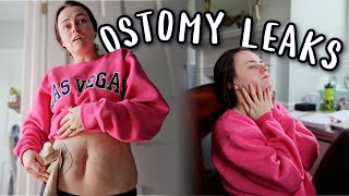 Im Over These Leaks So Im Ordering Different Ostomy Supplies  Lets Talk IBD [upl. by Venetis]