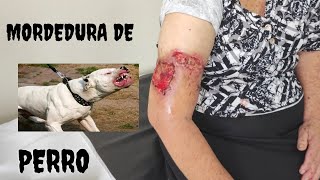 MORDEDURA DE PERRO [upl. by Lybis589]