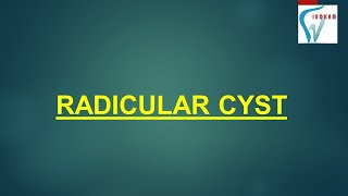 RADICULAR CYST  ENGLISH [upl. by Germann]