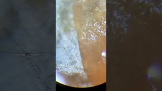 That Mold In Our Jam  Microscope [upl. by Hadeis]