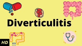 Diverticulitis Causes SIgns and Symptoms Diagnosis and Treatment [upl. by Enirehtak]