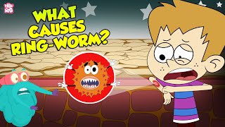 What Causes Ringworms  Skin Infection  The Dr Binocs Show  Peekaboo Kidz [upl. by Nelyahs758]