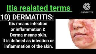 ITIS related terms PART1 Competative Exams  Hepatitis OTITIS MEDIA  The way of learning [upl. by Therese953]