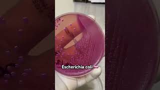 Escherichia coli 🧫🧫🧫🌝🌝bacteriologia Microbiologia LabClinico [upl. by Podvin843]