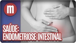 Endometriose intestinal  Saúde  Mulheres 210716 [upl. by Edmea]