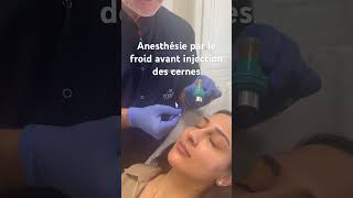 Anesthésie par le froid avant injections des cernes medecineesthetique cernes acidehyaluronique [upl. by Aneral]