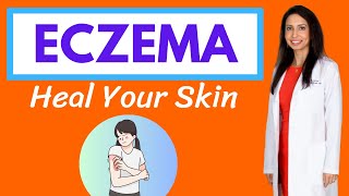 ECZEMA Dr Rajsrees Natural Protocol for Healing Your Skin [upl. by Nedyarb]