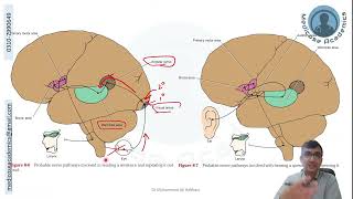 Speech amp Aphasia [upl. by Acisseg]