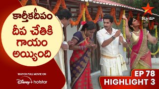 Karthika Deepam Episode78 Highlight3  దీప చేతికి గాయం అయ్యింది  Telugu Serials  Star Maa [upl. by Alyakcim]