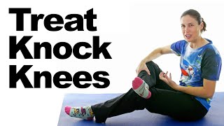 Treat Knock Knees with Easy Stretches amp Exercises [upl. by Llehcim]